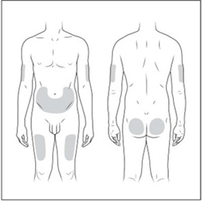 Places To Inject (Ifu Pen Places To Inj)